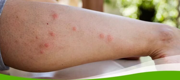 Warnung vor Bitesolgemokz